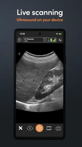 Clarius Ultrasound screenshot