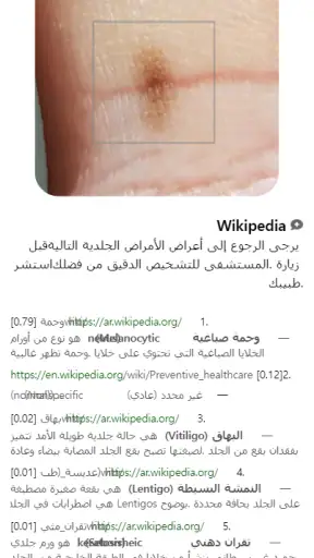 Model Dermatol – مرض جلدي screenshot