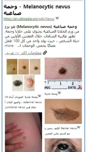 Model Dermatol – مرض جلدي screenshot