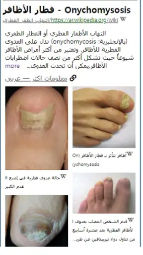 Model Dermatol – مرض جلدي screenshot