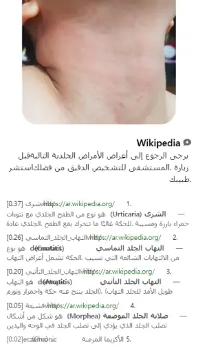 Model Dermatol – مرض جلدي screenshot