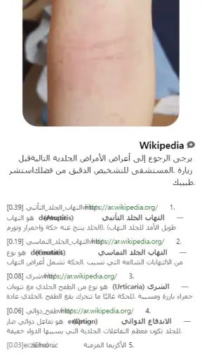Model Dermatol – مرض جلدي screenshot