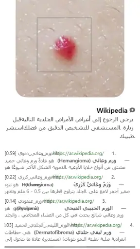 Model Dermatol – مرض جلدي screenshot