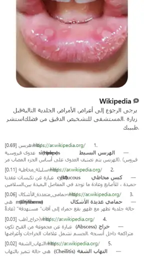 Model Dermatol – مرض جلدي screenshot