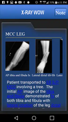 X-RAY WOW screenshot