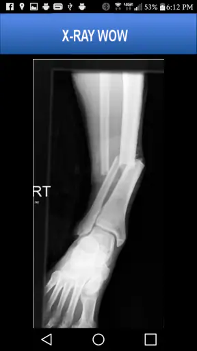 X-RAY WOW screenshot