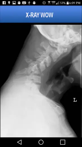 X-RAY WOW screenshot