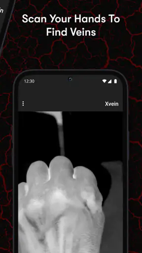 X-Vein screenshot