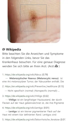 Model Dermatol – Hautkrankheit screenshot