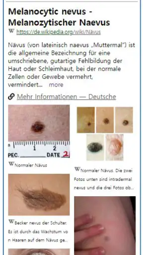 Model Dermatol – Hautkrankheit screenshot
