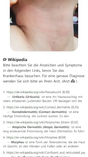 Model Dermatol – Hautkrankheit screenshot