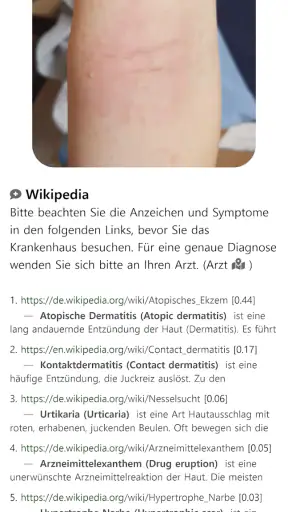 Model Dermatol – Hautkrankheit screenshot