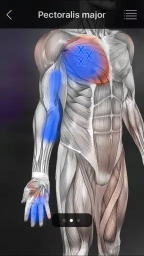 Muskel Triggerpunkte Anatomie screenshot
