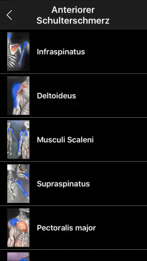 Muskel Triggerpunkte Anatomie screenshot