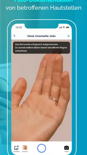 Neurodermitis App Nia screenshot