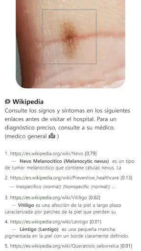 ModelDerm–Enfermedades la piel screenshot