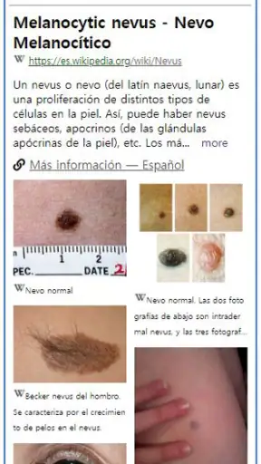 ModelDerm–Enfermedades la piel screenshot