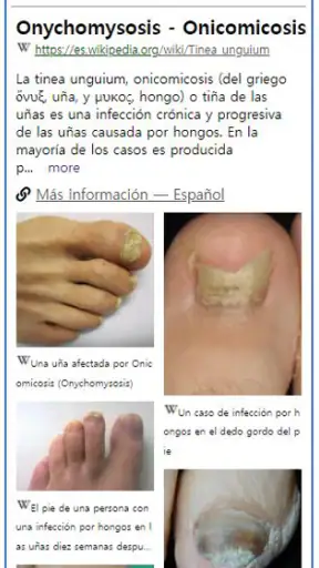 ModelDerm–Enfermedades la piel screenshot