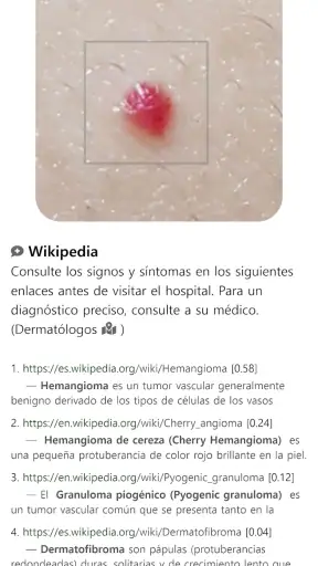 ModelDerm–Enfermedades la piel screenshot