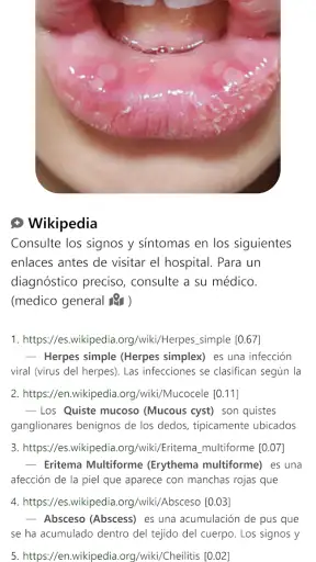 ModelDerm–Enfermedades la piel screenshot