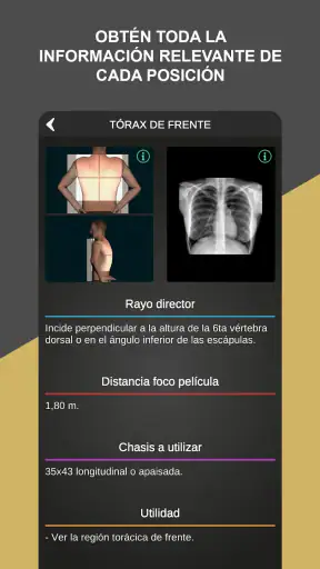RX - Posiciones Radiológicas screenshot