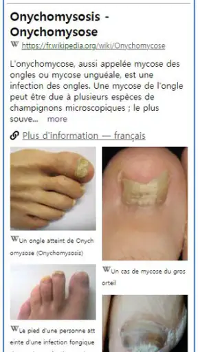 Model Derm – Maladie de peau screenshot
