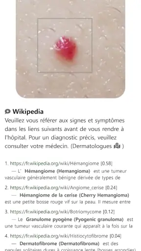 Model Derm – Maladie de peau screenshot
