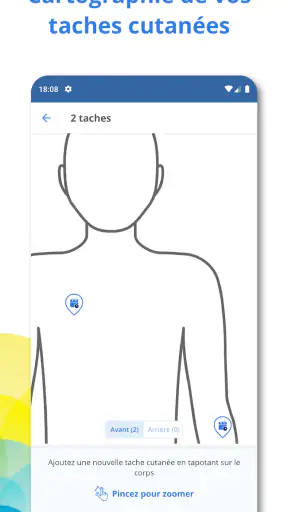 SkinVision screenshot