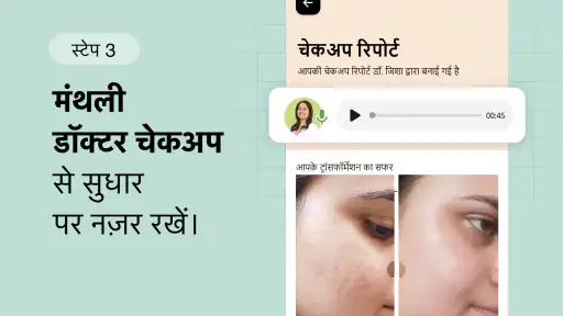 Cureskin स्किन एवं हेयर डॉक्टर screenshot