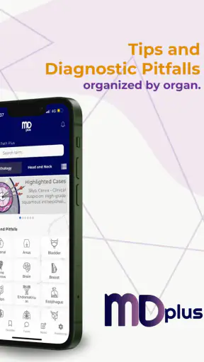 MD Plus screenshot