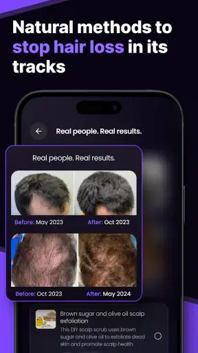 HairSnap Hair & Style Analysis screenshot