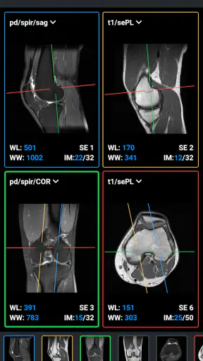 IDV - IMAIOS DICOM Viewer screenshot