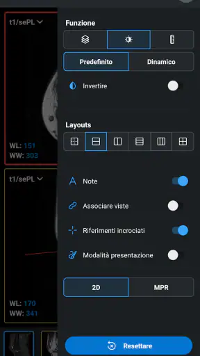 IDV - IMAIOS DICOM Viewer screenshot