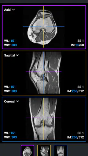 IDV - IMAIOS DICOM Viewer screenshot