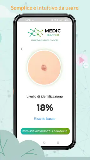 Medic Scanner - analisi pelle screenshot