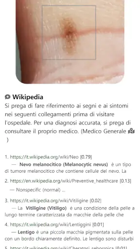 Model Dermatol – Skin Disease screenshot