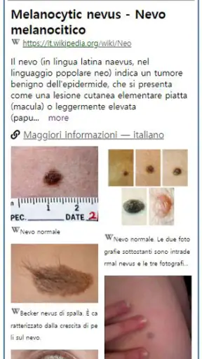 Model Dermatol – Skin Disease screenshot
