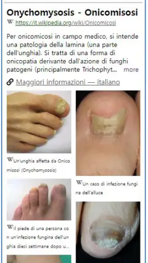 Model Dermatol – Skin Disease screenshot