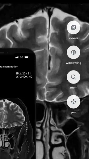 Philips MR Imaging screenshot