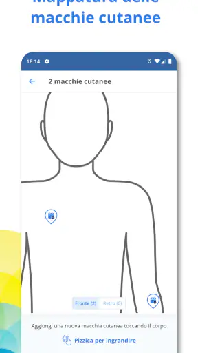 SkinVision screenshot