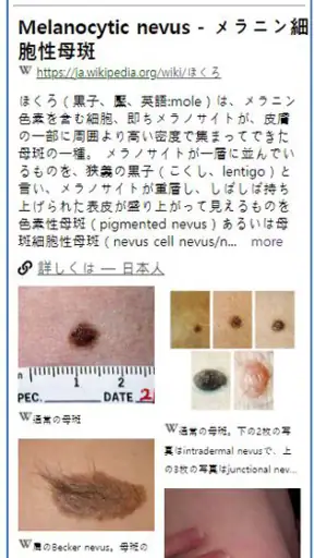 Model Dermatol – 皮膚疾患 screenshot