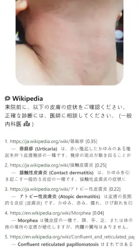 Model Dermatol – 皮膚疾患 screenshot