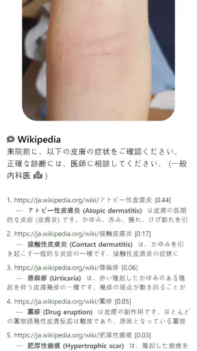 Model Dermatol – 皮膚疾患 screenshot