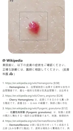 Model Dermatol – 皮膚疾患 screenshot