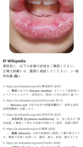 Model Dermatol – 皮膚疾患 screenshot