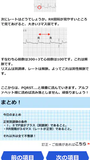 みんなde心電図 screenshot
