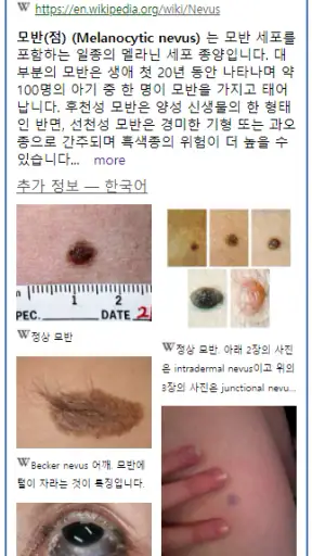 Model Dermatol – Skin Disease screenshot