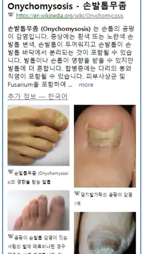 Model Dermatol – Skin Disease screenshot