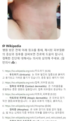 Model Dermatol – Skin Disease screenshot