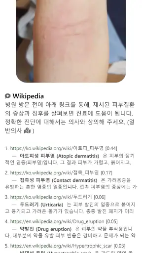 Model Dermatol – Skin Disease screenshot